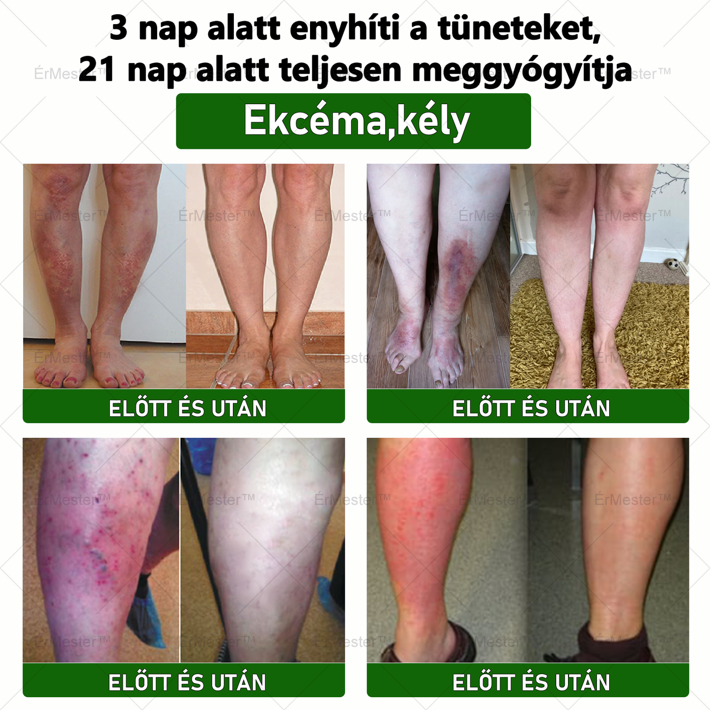 🌿🌿 ÉrMester™ Természetes Vénás Javító Lábfürdő Gélgolyók
