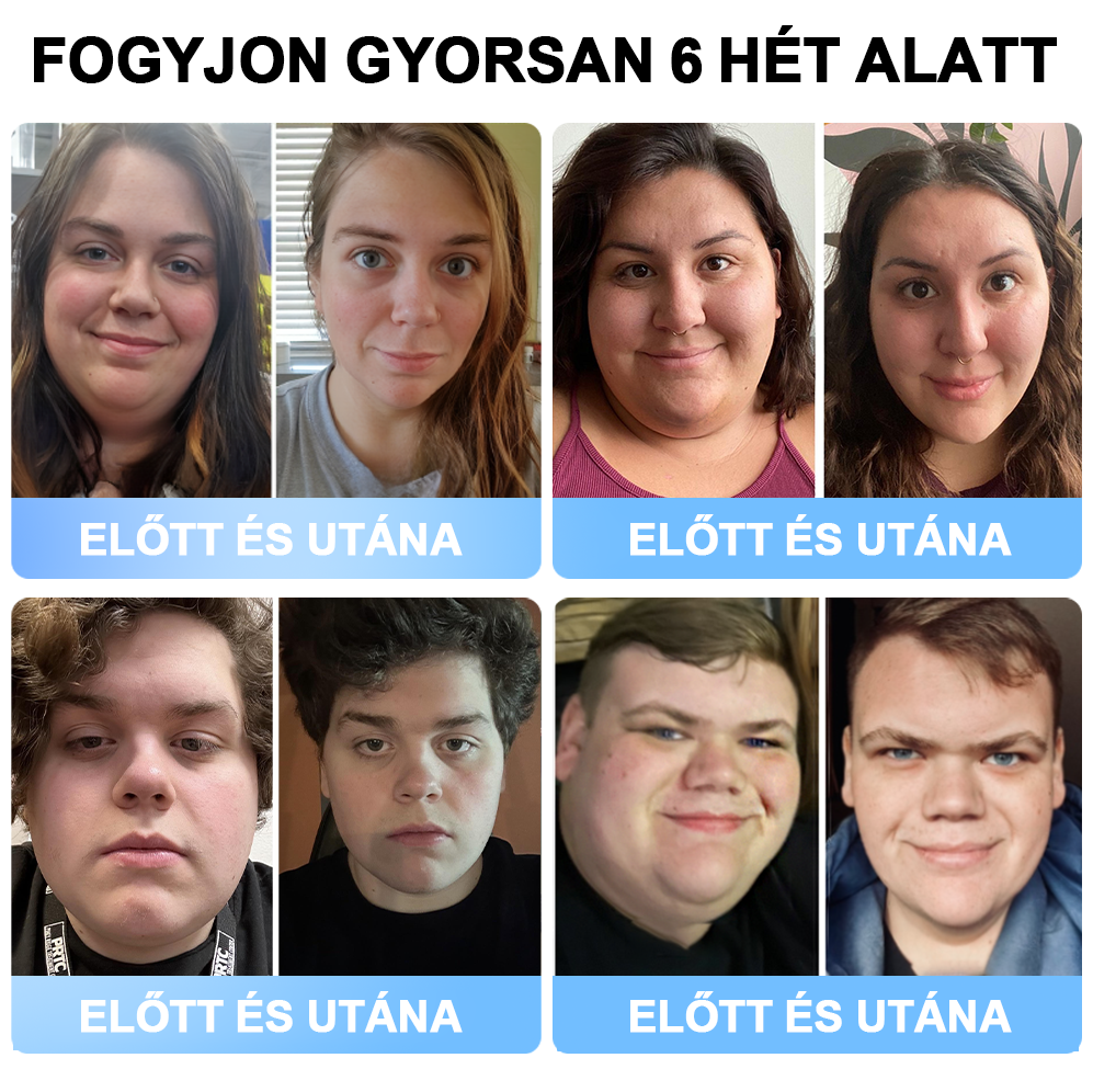 🎁FormaÉlet® 🌱Nano Mikrotű Tapasz SMGT-GLP-1-tel és Matrixyl 3000-rel – Fogyás, Bőrfeszesítés, Vércukorszint-támogatás, Injekció Nélkül, 7 Napos Eredmény 🎁