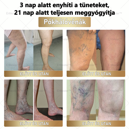 🏆 ÉrMester™  Természetes Vénás Javító Lábfürdő Gélgolyók