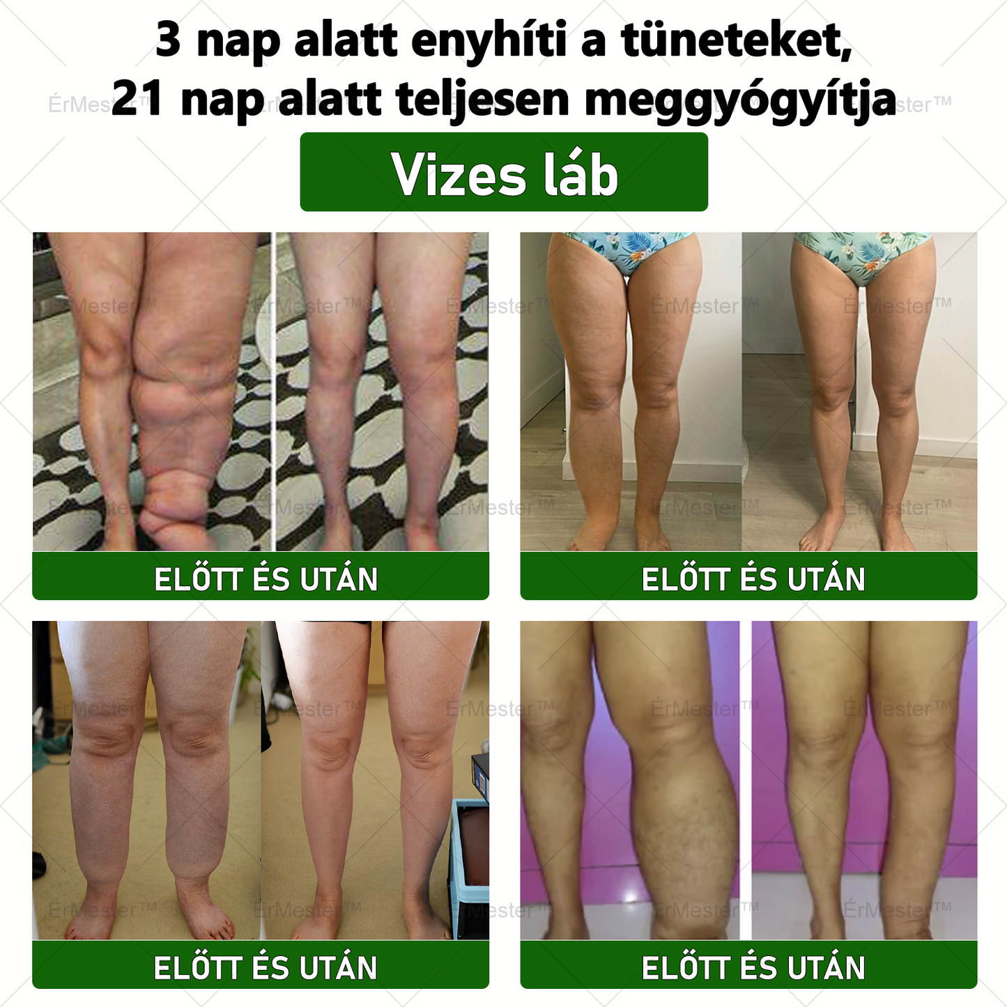 💥💥 Gratulálunk, hogy te is az első 200 rendelés egyikévé váltál! Élvezd az extra 50% kedvezményt! Cselekedj most, és teljesen gyógyítsd meg a vénás betegségeket, hogy visszanyerd az egészségedet! Ha most lemaradsz, csak jövőre lesz újabb lehetőség!