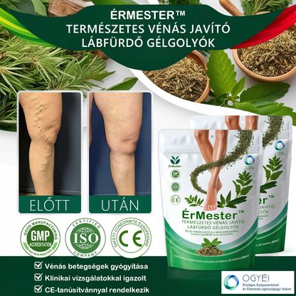 💥💥 Gratulálunk, hogy te is az első 200 rendelés egyikévé váltál! Élvezd az extra 50% kedvezményt! Cselekedj most, és teljesen gyógyítsd meg a vénás betegségeket, hogy visszanyerd az egészségedet! Ha most lemaradsz, csak jövőre lesz újabb lehetőség!